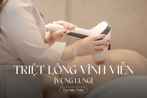 Triệt lông vùng lưng vĩnh viễn